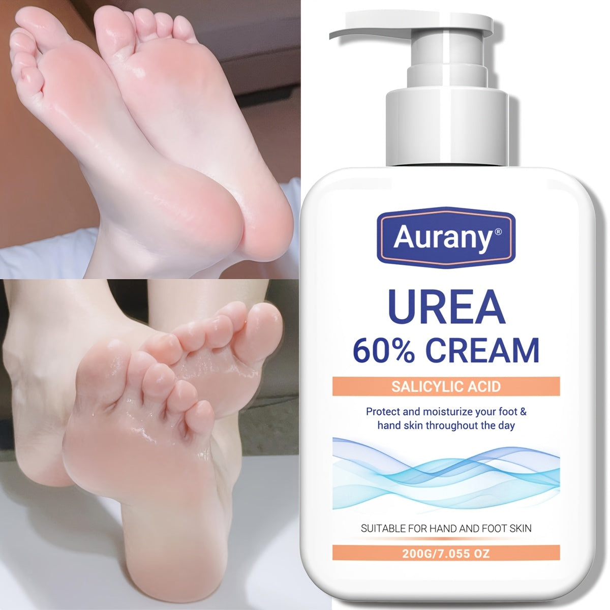 60% Urea Hand & Foot Cream with Salicylic Acid – 200g